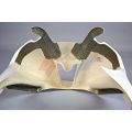 Tete de fourche GRP pour Yamaha R6 08-16 1